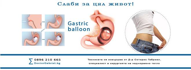 Поставяне на стомашен балон (gastric balloon) с помощта на ендоскопска апаратура – Д-р Габриел, специалист в хирургия на…