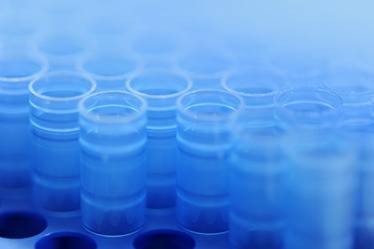 Защо в Свети Лазар