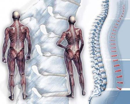 Безплатни прегледи в Пирогов за гръбначни изкривявания