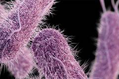 ВЪРНЕТЕ СИ КОМФОРТА ПРИ ЦИСТИТ И ВЪЗПАЛЕНИЯ НА ПИКОЧНО-ПОЛОВАТА СИСТЕМА