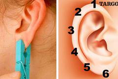 Просто сложете щипка за пране на някоя от тези точки и вижте какво ще се случи!