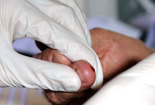 Безплатни тестове са хепатит С в Гоце Делчев