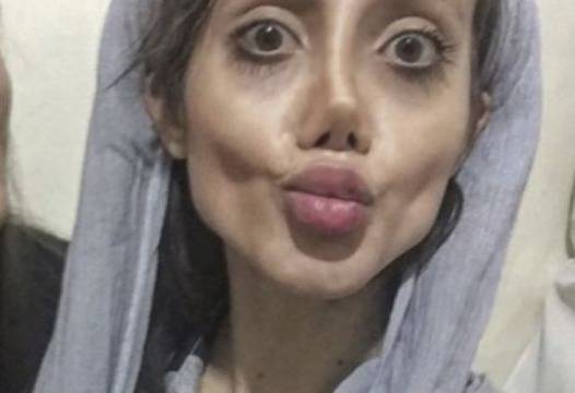 Иранката с 50 пластични операции разказва за негативните коментари