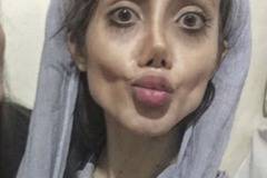 Иранката с 50 пластични операции разказва за негативните коментари