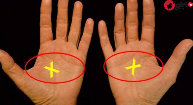 Какво значи, ако имате редкият „Х“ на дланта си
