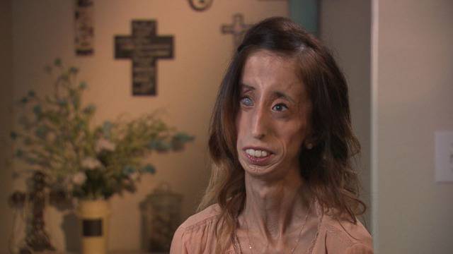 Вижте тъжната история на „най-грозната жена в света“!