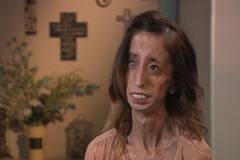 Вижте тъжната история на „най-грозната жена в света“!