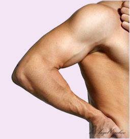 Оформяне на бицепс чрез Biceps силиконови импланти – Пластична хирургия д-р Ангел Енчев