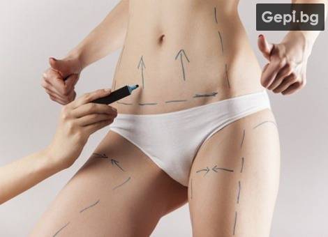 Метод за бързо отслабване без диети с ултразвукова липосукция