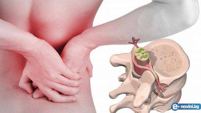 Наш народен лечител разби на пух и прах бялата мафия! Вижте как да се излекувате от дисковата херния за дни!