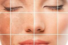 Редувайте тези маски: Пигментните петна ще изчезнат, а бръчките намалеят