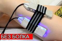 Премахване на целулит с ултразвукови плочи