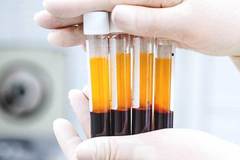 Плазмотерапия – Имплантология – лечение със зъбни импланти