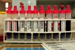 Изследват по нов начин дарената кръв за скрити зарази