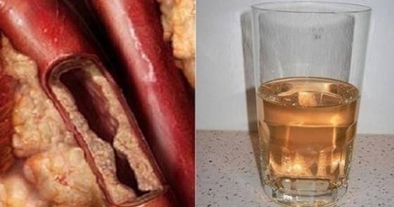 Забравих за хапчетата! Просто пия тази домашна напитка и съм нов човек! Изчисти всички мръсотии от тялото ми!