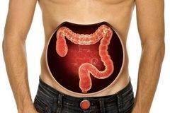 Безплатни прегледи за рак на дебелото черво