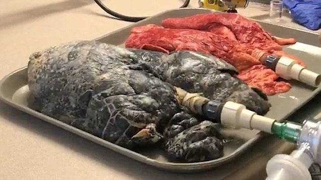 Медицинска сестра показа нагледно каква е разликата между бял дроб на пушач и непушач (видео)