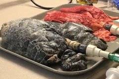 Медицинска сестра показа нагледно каква е разликата между бял дроб на пушач и непушач (видео)