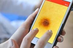 ВМА се включва в Националната кампания за профилактика на рак на кожата