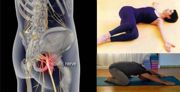 Ето как да освободим прищипан нерв и да премахнем болката. Нещо, което всеки трябва да знае