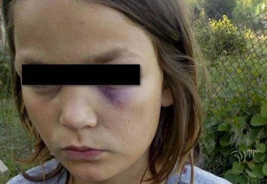 Ученици се пребиха пред погледа на учителите си в Бургаско, вдигнаха накрак полиция и Бърза помощ (СНИМКИ)