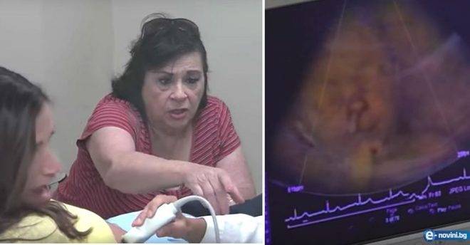Бъдеща баба отива с бременната си дъщеря на ултразвук да види внучето, но изпада в шок, когато..