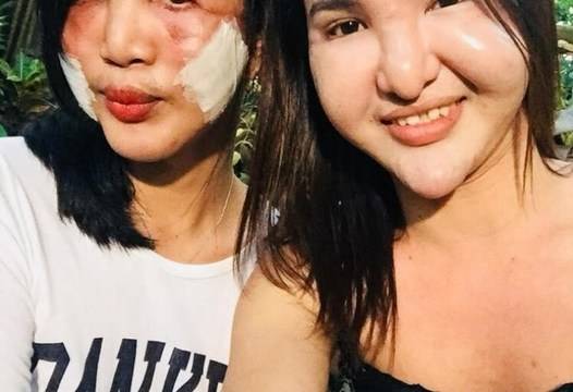 Страшна гледка: Две приятелки решиха да бъдат красиви и отидоха на козметик. Вече 10 години всички им се присмиват.