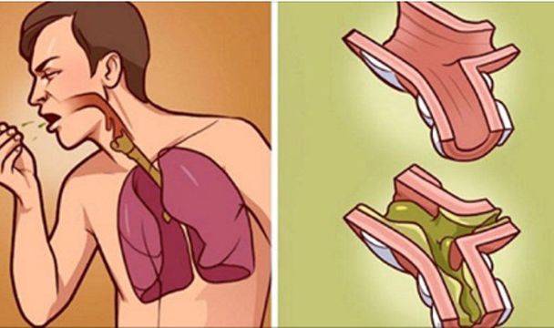 Действа за 2 часа и стават като нови: Изчистете белите дробове от лепкавия секрет!