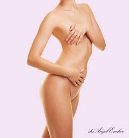 Естетични корекции на тяло в Пластична хирургия д-р Ангел Енчев