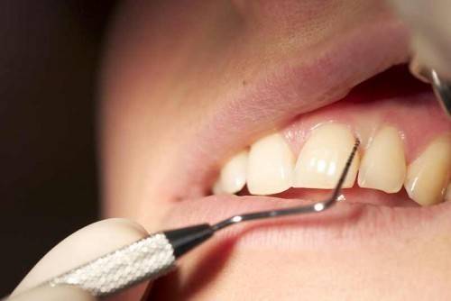 Какви са причините за възпаление на венеца?