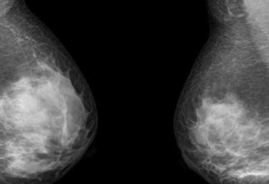 Лекари ще ви кажат да не се притеснявате, но тези симптоми крещят, че имате рак!