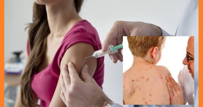 Ужасна болест върлува из Европа.