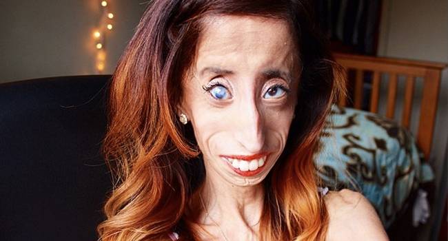 Вижте тъжната история на „най-грозната жена в света“!