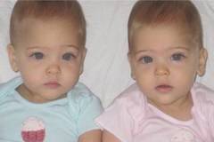 Тези близначки се родиха през 2010 година. Осем години по-късно вече са най-красивите деца на света! СНИМКИ