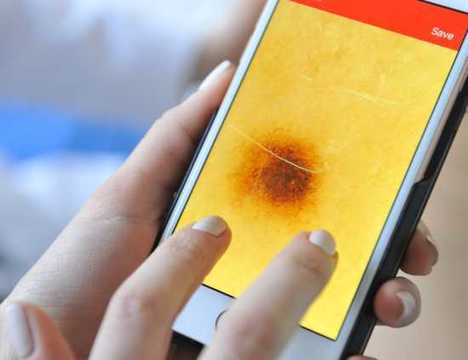 Безплатни прегледи при кожен лекар в София