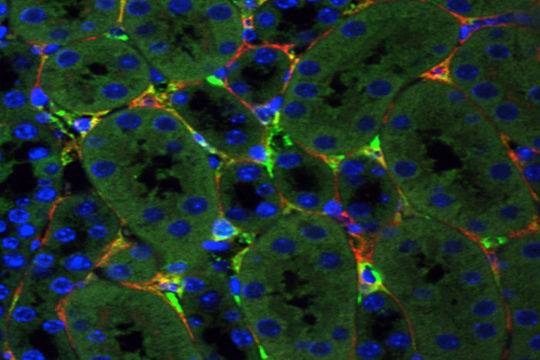 Нов метод за генна терапия на увредени бъбречни клетки