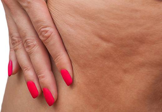 Отървете се от целулита само за 7 дни с тази магическа диета