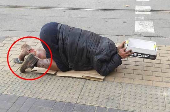 Докъде се докарахме! Бедстващ човек с ужасни рани проси милостиня на Витошка