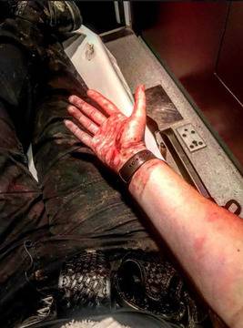 Млада полицайка показа цената на залавянето на откачил наркоман (СНИМКИ)