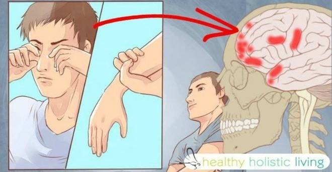 Кардиолозите казват, че ако им кажете това, най-малко 10 души, ще се спасят навреме-4 ясни индикации, че ще получите инсулт…