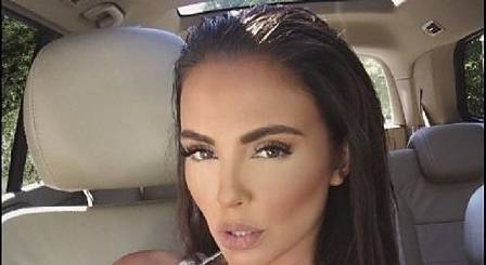 Николета Лозанов с шина на крака. Може да не влезе във „ВИП Брадър“ (СНИМКА)