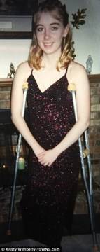 Историята на Кристи, която си отряза единия крак, за да облече къса пола за пръв път от 20 години (СНИМКИ)