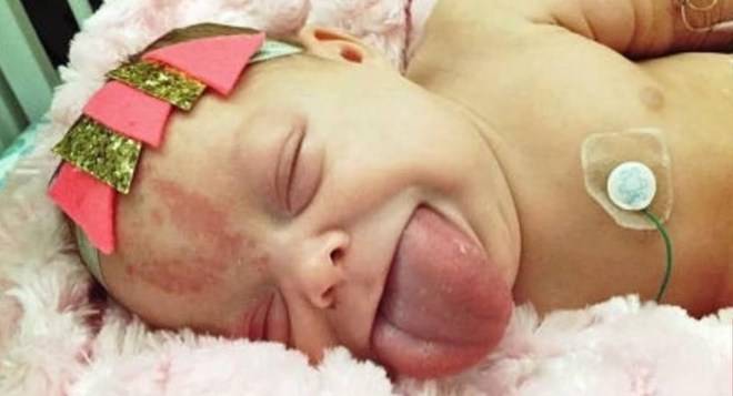 Когато това бебенце се появи на бял свят родителите му изпаднаха в ужас, но само го вижте сега (снимки)
