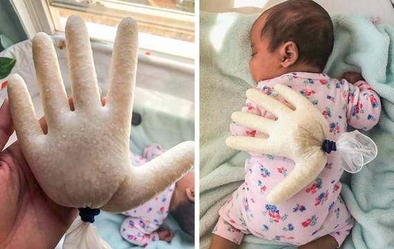 Родители сложиха гумена ръкавица, пълна с ориз, върху бебето си! Причината е потресаваща