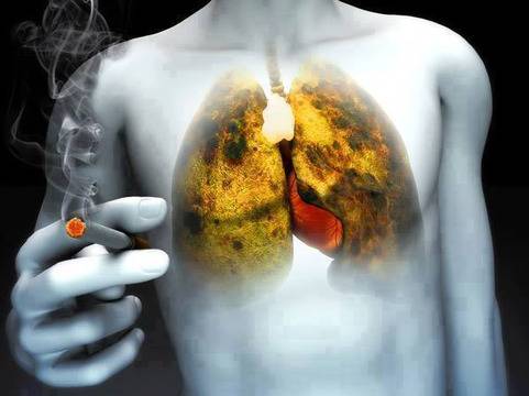 За пушачи и бивши пушачи: Вижте как бързо и ефективно да изчистите белия дроб само за 3 дни!
