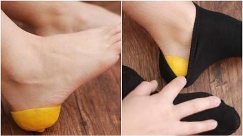 Напукани пети: Лимонова кора за 30 минути прави кожата гладка