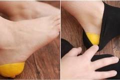 Напукани пети: Лимонова кора за 30 минути прави кожата гладка
