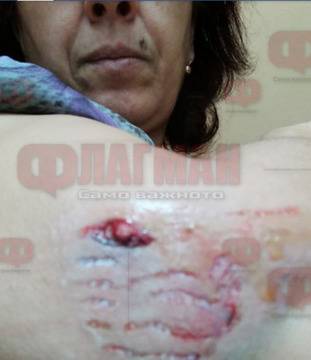 Бесен ротвайлер нахапа бургазлийка, стопанката му наглее