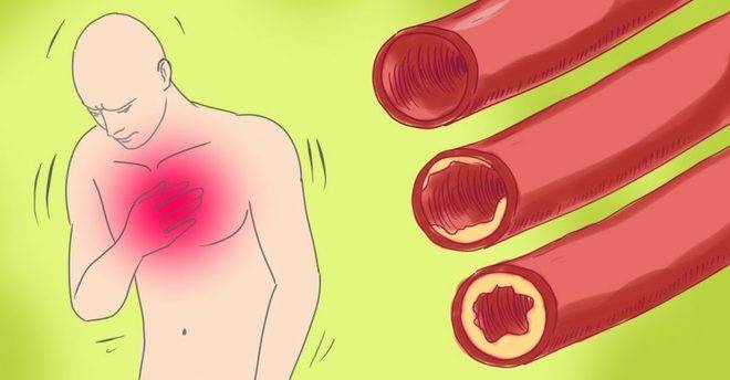 Естествено прочистване на кръвоносните съдове без никакви хапчета! Кръвното ви винаги ще е 120 на 80!