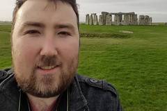 29-годишният Джейми: Умрях 9 пъти и не знам защо все още съм жив (СНИМКИ)